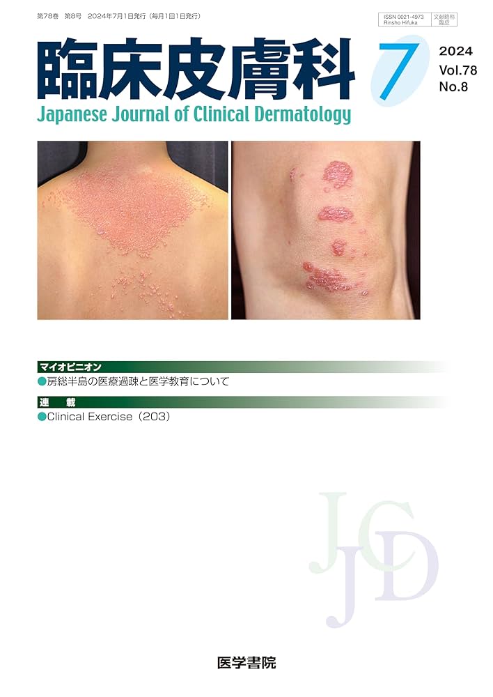 臨床皮膚科 2024年 7月号 | 医学書院 |本 | 通販 | Amazon