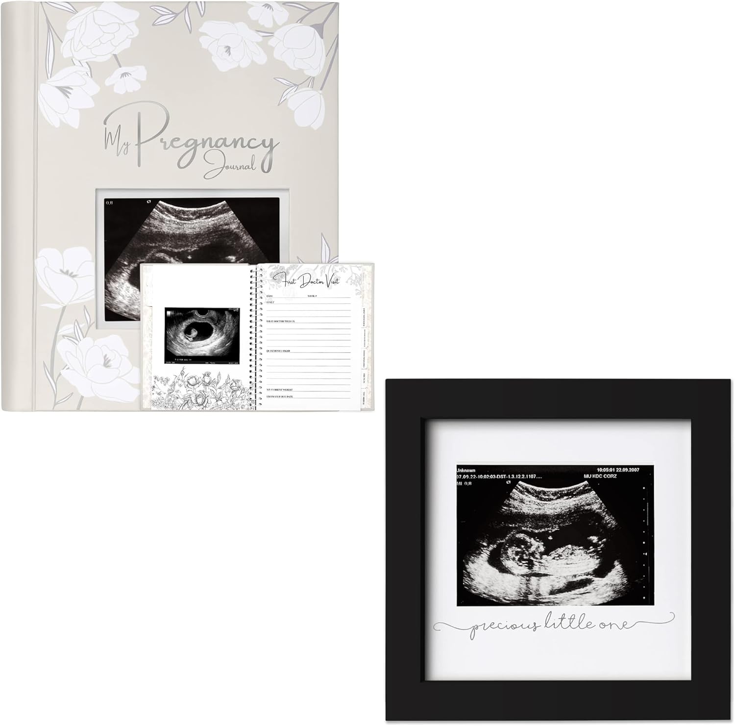 KeaBabies Pregnancy Journal, Modern Ultrasound Picture Frame for Baby Announcements, 80 Pages Hardcover Book for Mom-to-Be, Includes Checklists and Memories