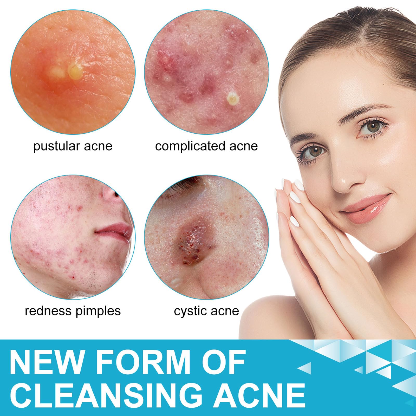 Shefave Pimple Parches Micro Needle, parche hidrocoloide, parches para microagujas para eliminar el acné rápidamente, invisibles y resistentes al agua, parches antiespinillas, día y noche