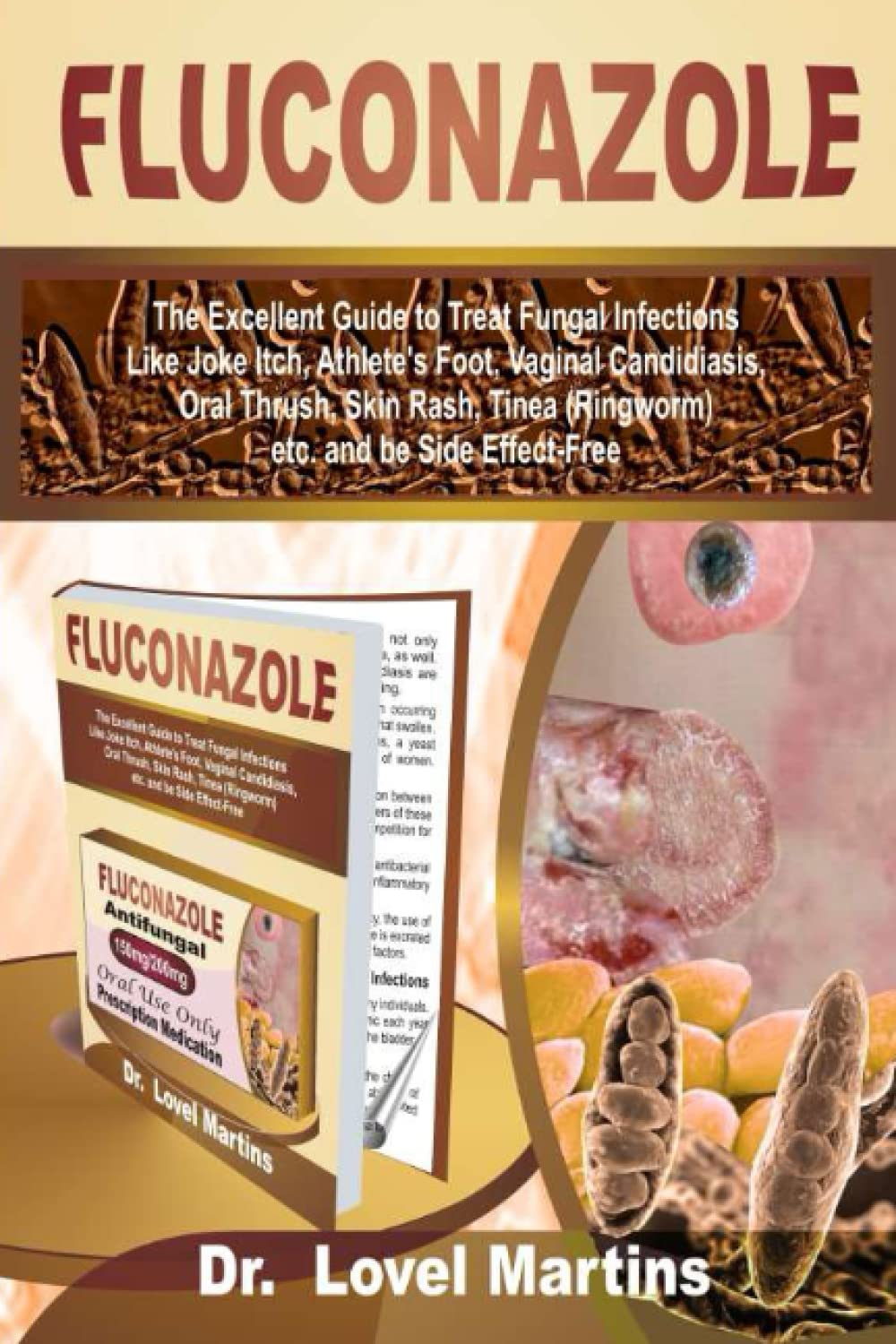 Buy FLUCONAZOLE The Excellent Guide to Treat Fungal Infections Like