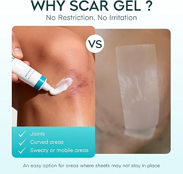 Aroamas Scar Advanced Scar Gel - Medical-Grade Silicone Scar Gel to Help Improve The Appearance of Scars and Stretch Marks for Face & Body - 45g