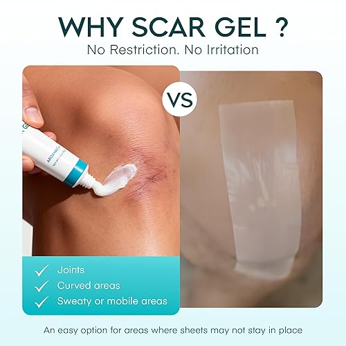 Miniatura 4 de Aroamas Scar Gel avanzado para cicatrices, gel de silicona de grado médico para cicatrices quirúrgicas, para cara, gel de cicatrices con silicona