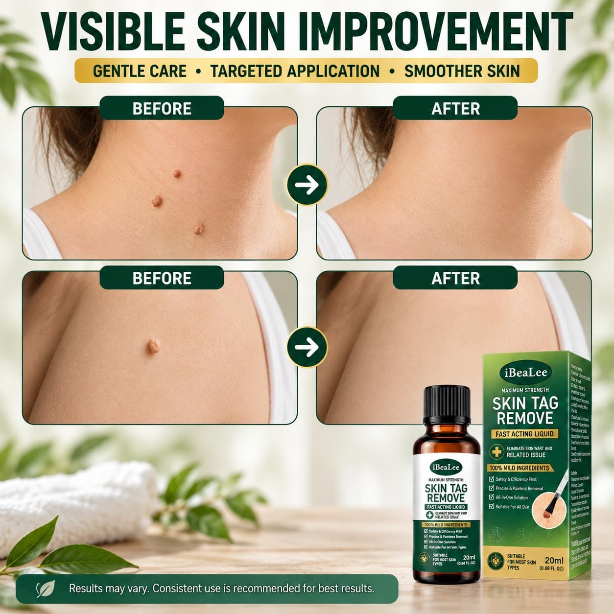 Skin Tag Remover with Salicylic Acid, Fast-Acting Botanical Liquid Formula with Precision Brush for Gentle, Targeted At-Home Care on the Neck, Underarms, Hands and Feet, 0.67 Fl Oz (20 mL)