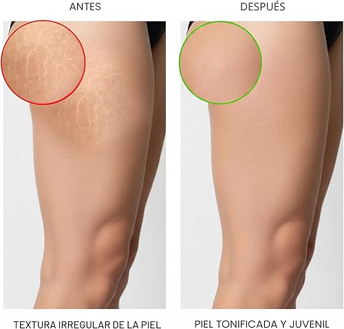 Vista 5 de MAJESTIC PURE Aceite de masaje para celulitis, con colágeno vegano y células madre, mezcla única de aceites esenciales para masaje, aceite anti