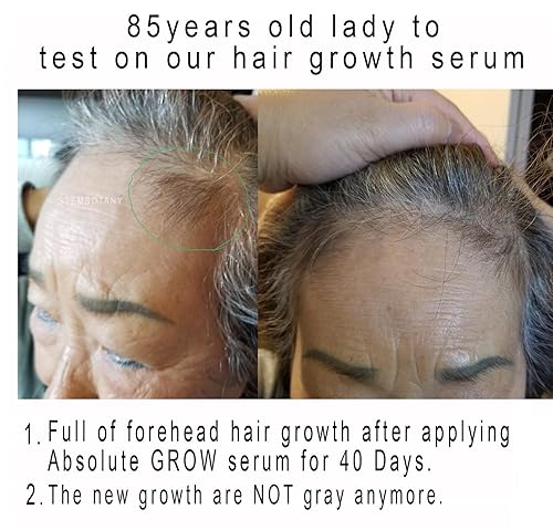 Miniatura 4 de Crecimiento absoluto GHK-cu suero de crecimiento del cabello con péptido de cobre para adelgazar el cabello