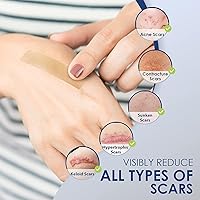 Vista 4 de Hojas de silicona para la eliminación de cicatrices quirúrgicas: cinta reutilizable para tratamiento de cicatrices queloides, cesáreas