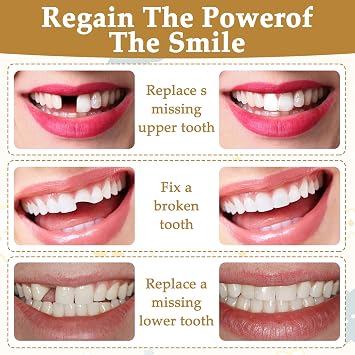 120 Pcs Temporary Tooth Cap,Front & Back Temporary Crowns for Teeth Broken Chipped & Lost Crown Repair,Compact and Portable No Easy Falling