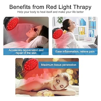 家庭用エキシマライト光線 UVB LIGHT THERAPY DEVICE Amazon | エキシマライト光線 308エキシマーシステム 家庭用