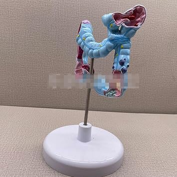 Colon Pathological Model Large Intestine Model Medical Anatomy Teaching in Gastroenterology Department of Anorectal Department Teaching Tool Teaching Aids [Energy Class A]