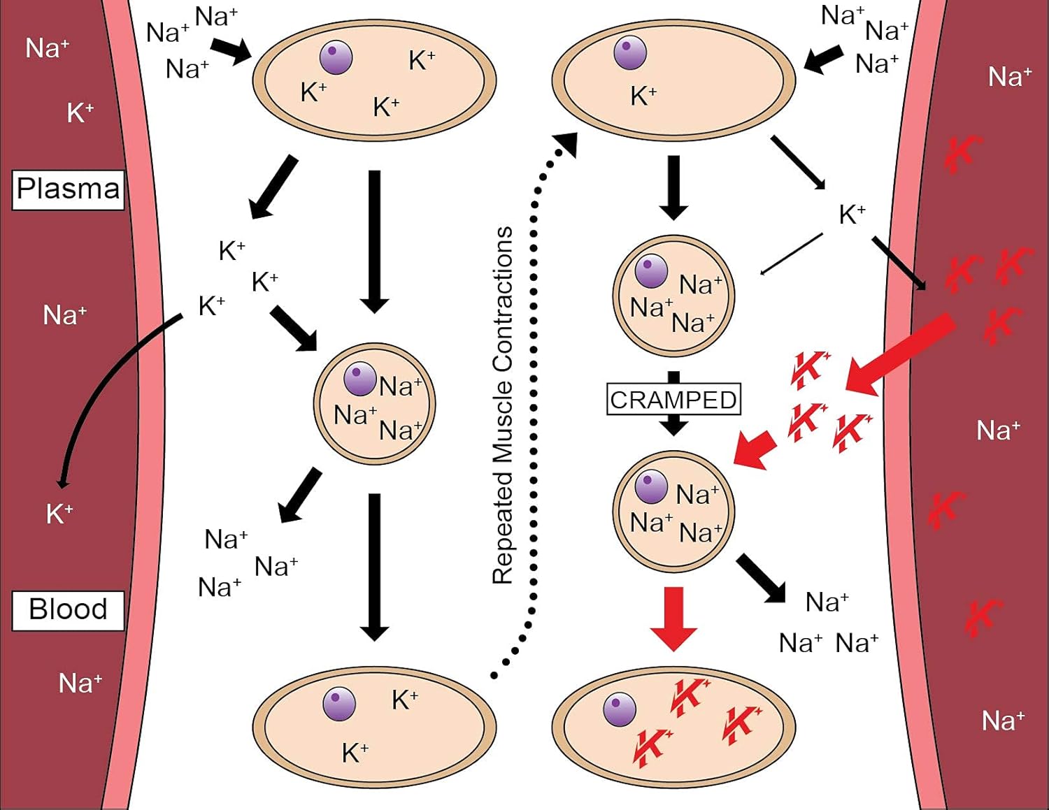 Krampade Anti-Cramping Potassium Replacement Sports Drink - 2K Fruit Punch Single Serve Colorless : Grocery & Gourmet Food