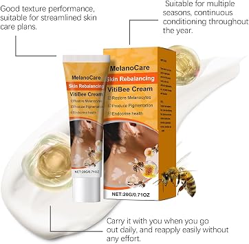 White Spot Removal Cream, Brightening Skin Lotion, Hydrating Face Cream, Targeted Spot Correction, With Hydrating And Brightening Formula, 1.81x3.66 Inches, For Daily Use On The Face And Body