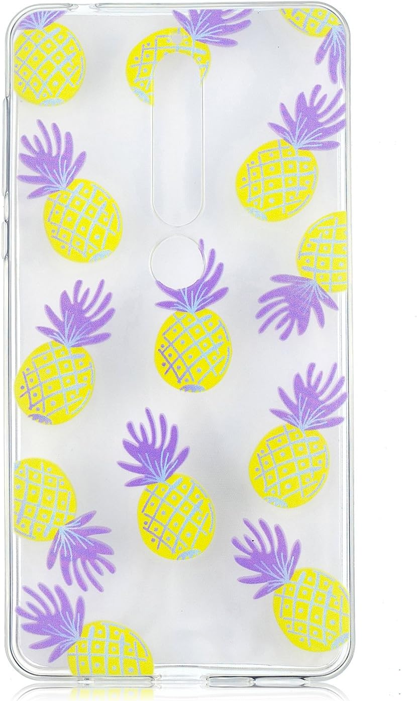 8 Best Nokia 6 Cases and Covers You Can Buy