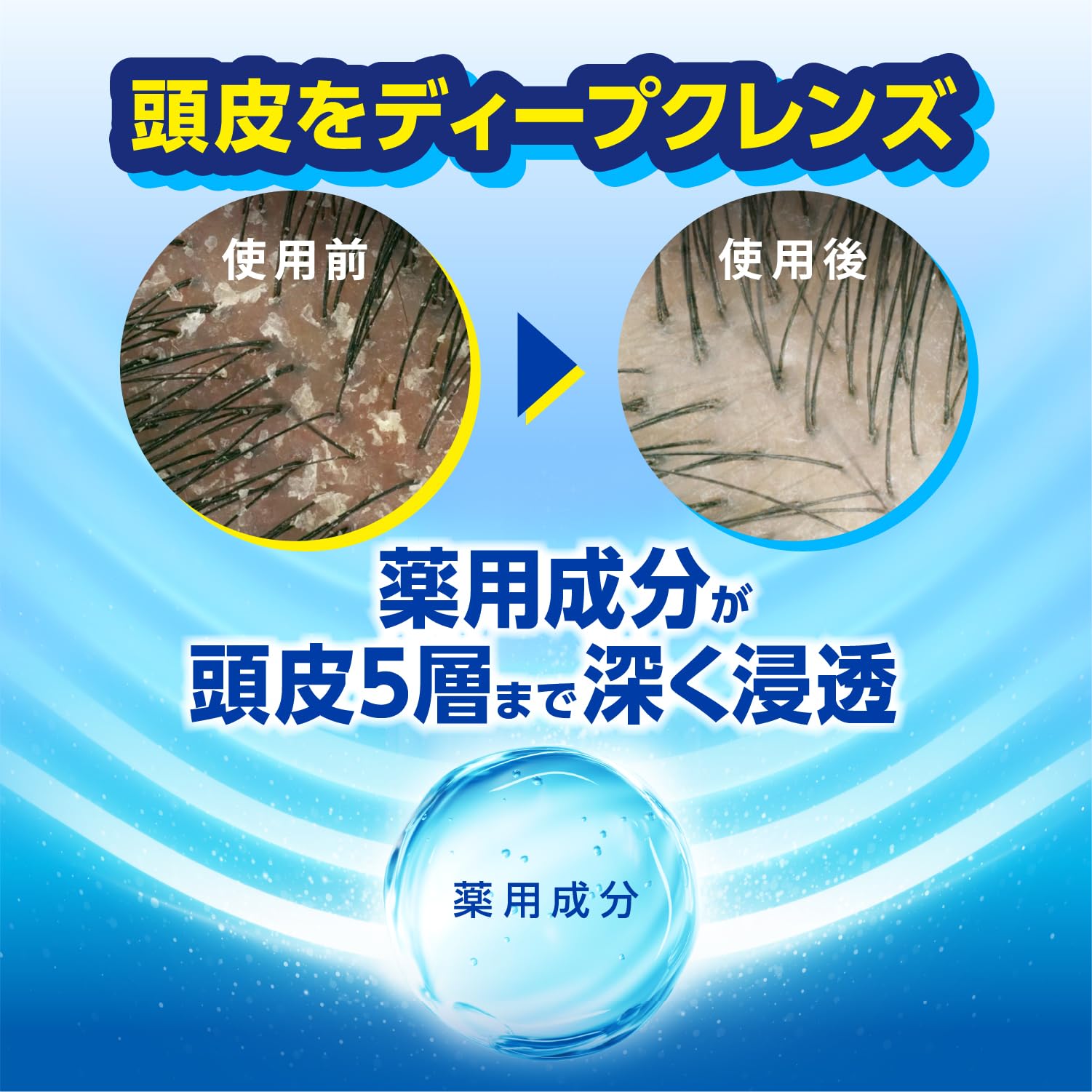 Amazon | h&s [新モデル] シャンプー グリーンゼラニウムドライ