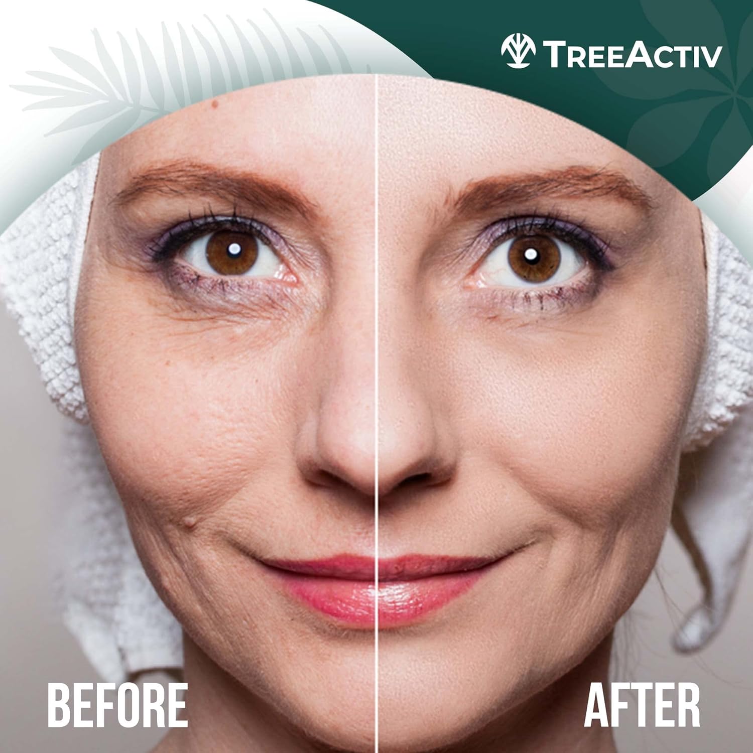 Buy TreeActiv Crepey Skin Repair Treatment, 8oz, Firming Crepe Skin