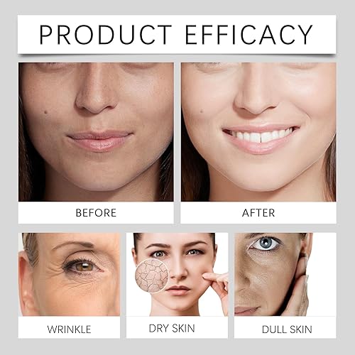 Miniatura 6 de Suero antienvejecimiento de vitamina C con retinol, ácido hialurónico, péptidos, colágeno, vitamina E para iluminar, hidratar, reafirmar, 1 onza