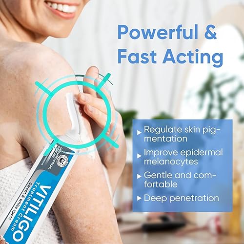 Miniatura 5 de Yakitoko Tratamiento de vitíligo, crema de vitíligo mejora la pigmentación de la piel y reduce las manchas blancas, adecuado para vitíligo de la