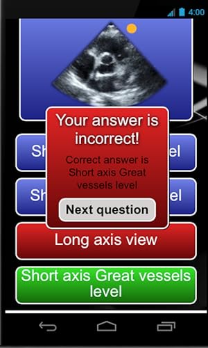 Echocardiography cases
