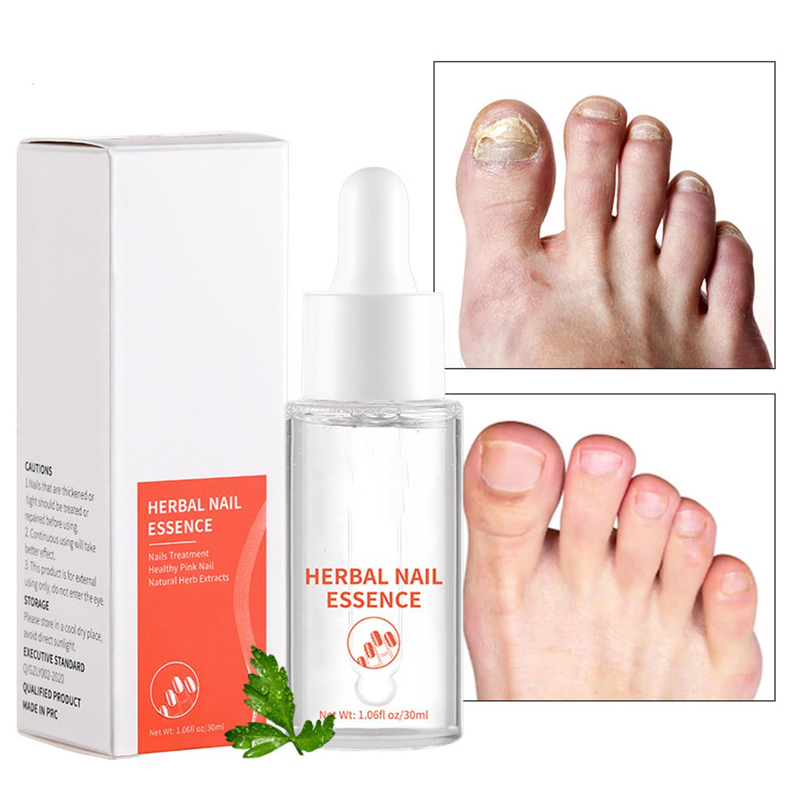 Sérum De Croissance Et De Renforcement des Ongles, Solution De Traitement De Réparation des Ongles 30 Ml, Sérum De Renforcement de la Croissance des Ongles Doux à Base De Plantes Pour les Ongles des P