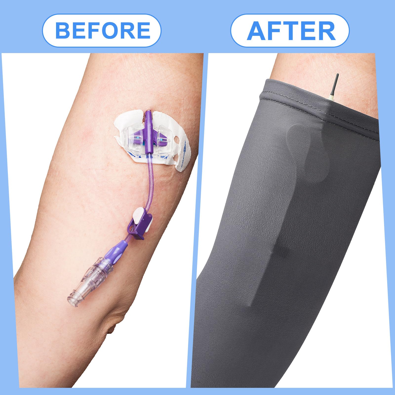 Cuffbow PICC Line Sleeve Cover for Adults PICC Line Sleeve Protector Reutilizable PICC Sleeve Breathable Arm Cast Cover Elastic Line Sleeve for PICC Nursing Supplies (Solid Style)