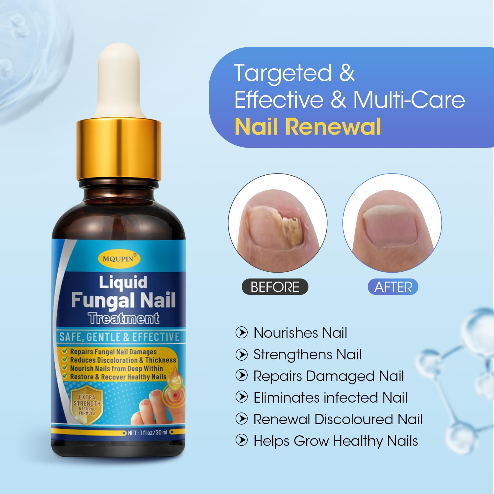 Fungal Nail Treatment For Toenails Extra Strong,MQUPIN Nail Fungus Treatment For Toenail & Finger - Image 2