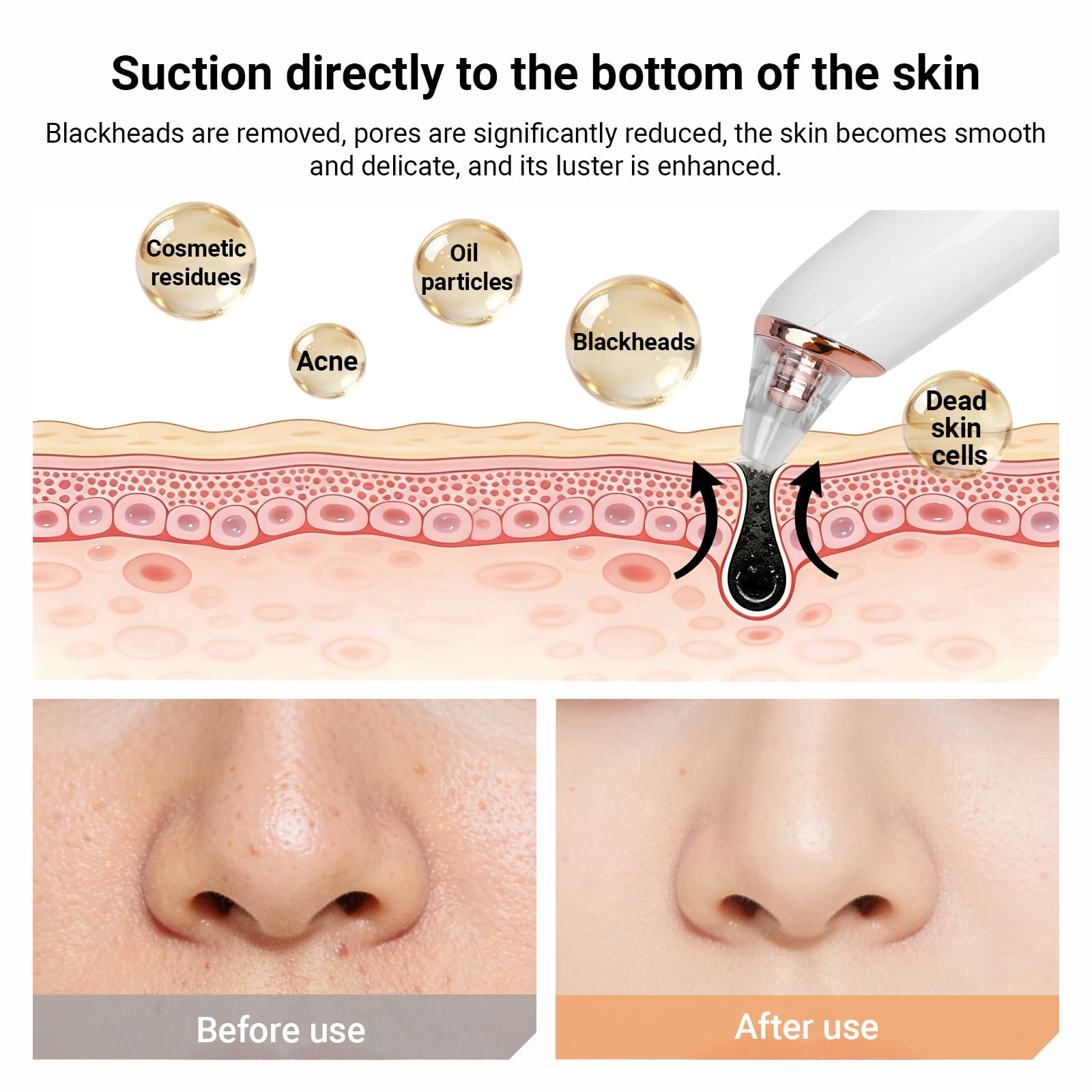 Aspirateur Point Noir 6 Sondes et 3 Modes, Extracteur Point Noir pour l'élimination des Blackheads, Boutons, Graisse