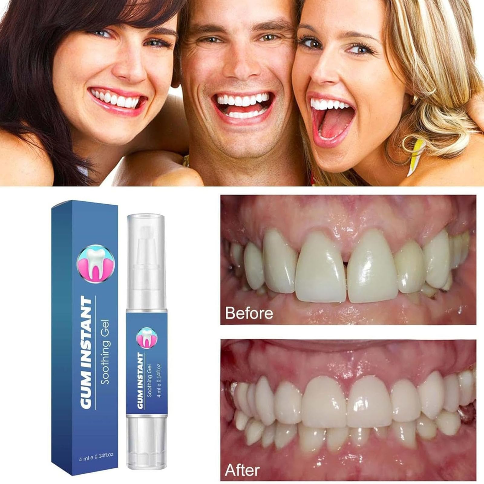 Gel pour les gencives GumEase, Gel réparateur dentaire Gum Ease, Gels apaisant instantané pour les gencives, Stylo réparateur d'essence pour les dents, Haleine fraîche (3Pcs)