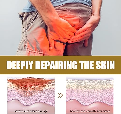 Miniatura 4 de Ungüento para hemorroides herbales chinas, paquete de 3, crema hemorroidal natural para aliviar la picazón y el ardor con Sophora, felodendro,