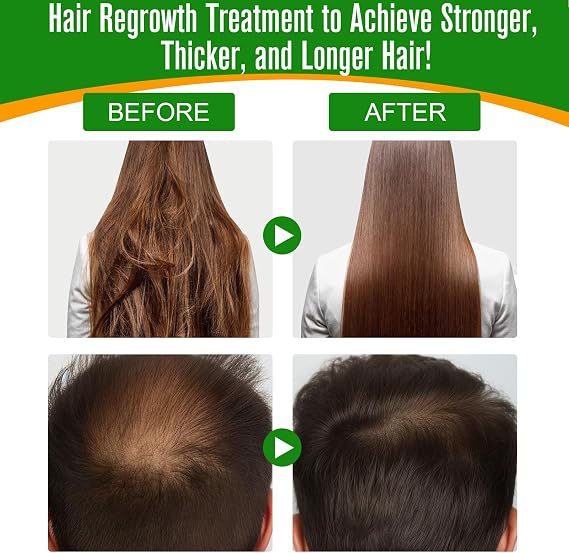 Batana Oil for Hair Growth 60ml, Batana Oil Organic Cold Press, Repairs Damaged Hair, Eliminates Split Ends & Increases Shine, Prevents Hair Loss & Breakage, Nourishes Scalp (1 PACK)