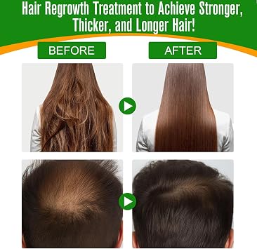 Batana Oil for Hair Growth 60ml, Batana Oil Organic Cold Press, Repairs Damaged Hair, Eliminates Split Ends & Increases Shine, Prevents Hair Loss & Breakage, Nourishes Scalp (1 PACK)