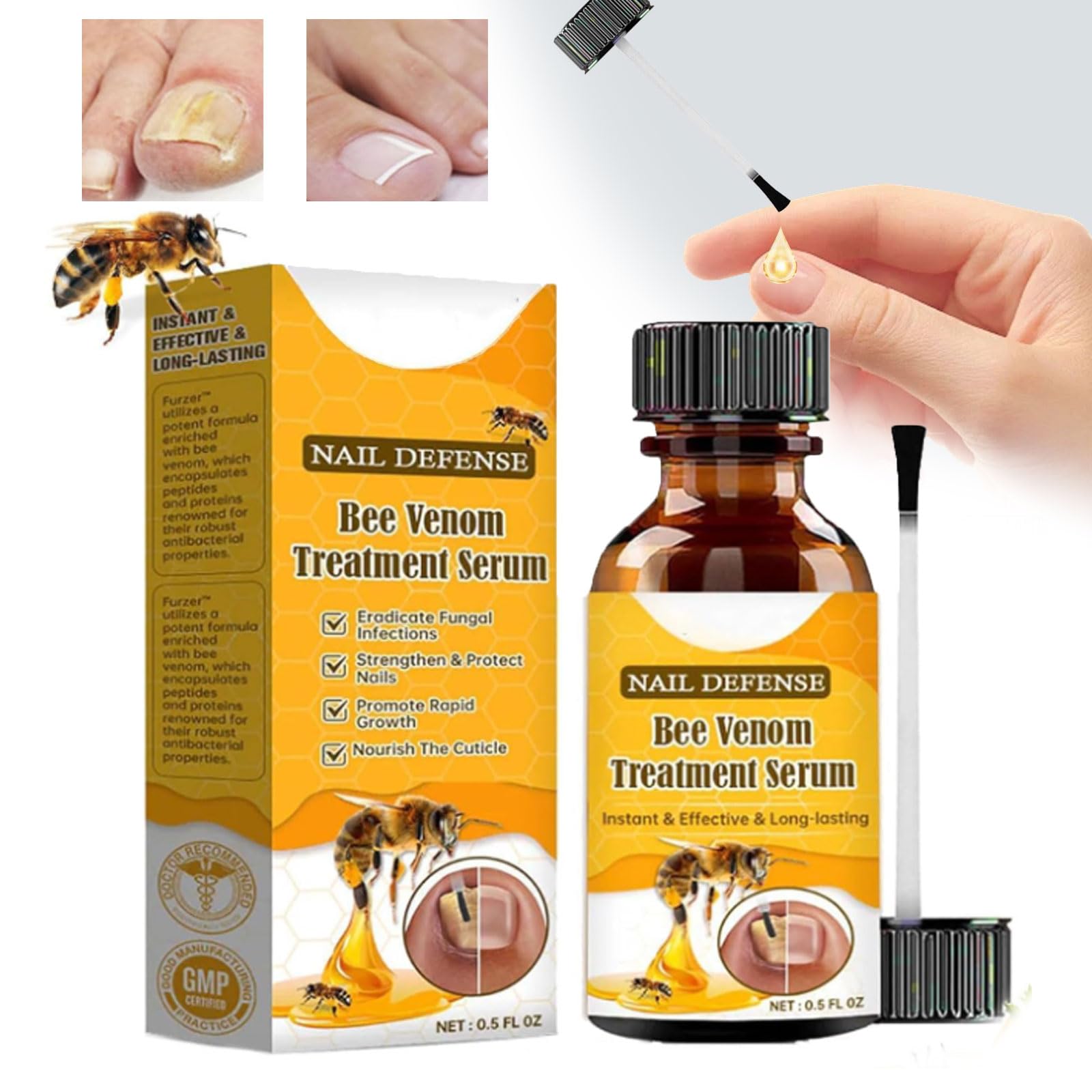 Trattamento per unghie incarnite al veleno d'api, siero per il trattamento delle unghie, siero per la crescita e la riparazione delle unghie, trattamento per unghie incarnite, trattamento con olio per