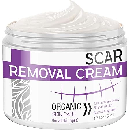 cream to remove marks on skin