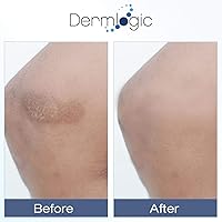 Vista 4 de Vitamin K Cream- Moisturizing Bruise Healing Formula. Dark Spot Corrector for Bruising, Spider Veins & Broken Capillaries. Reduces Under Eye Dark