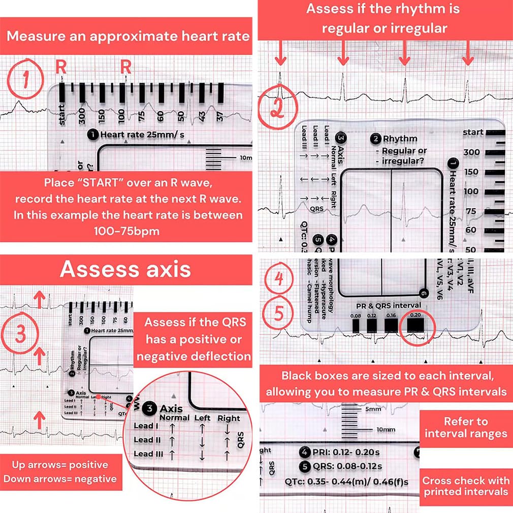 2 sztuki linijki EKG z 7 krokami, karta linijki EKG przezroczyste narzędzie pomiarowe EKG, 7-stopniowa interpretacja EKG/EKG, narzędzie pomiarowe dla rodzin, studentów, ratowników medycznych