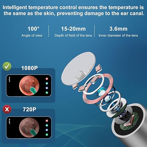 Miniatura 2 de Herramienta de eliminación de cera de oído, limpiador de oídos con cámara de otoscopio HD 1080P, otoscopio de cámara de oído con luz, 6 luces LED,