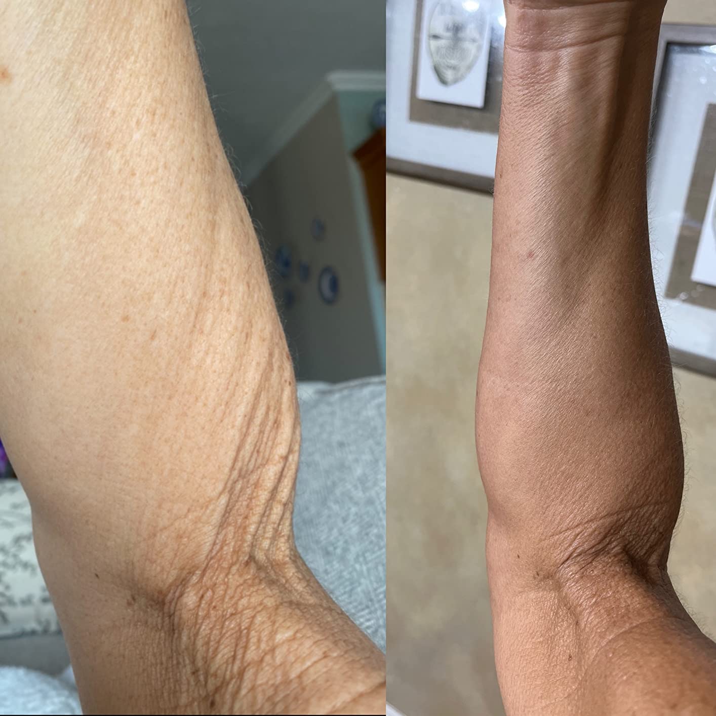 City Beauty InvisiCrepe Body Balm - Skin Firming & Tightening Lotion for a Smoother, Firmer Look | Anti-Aging Firming Body Cream