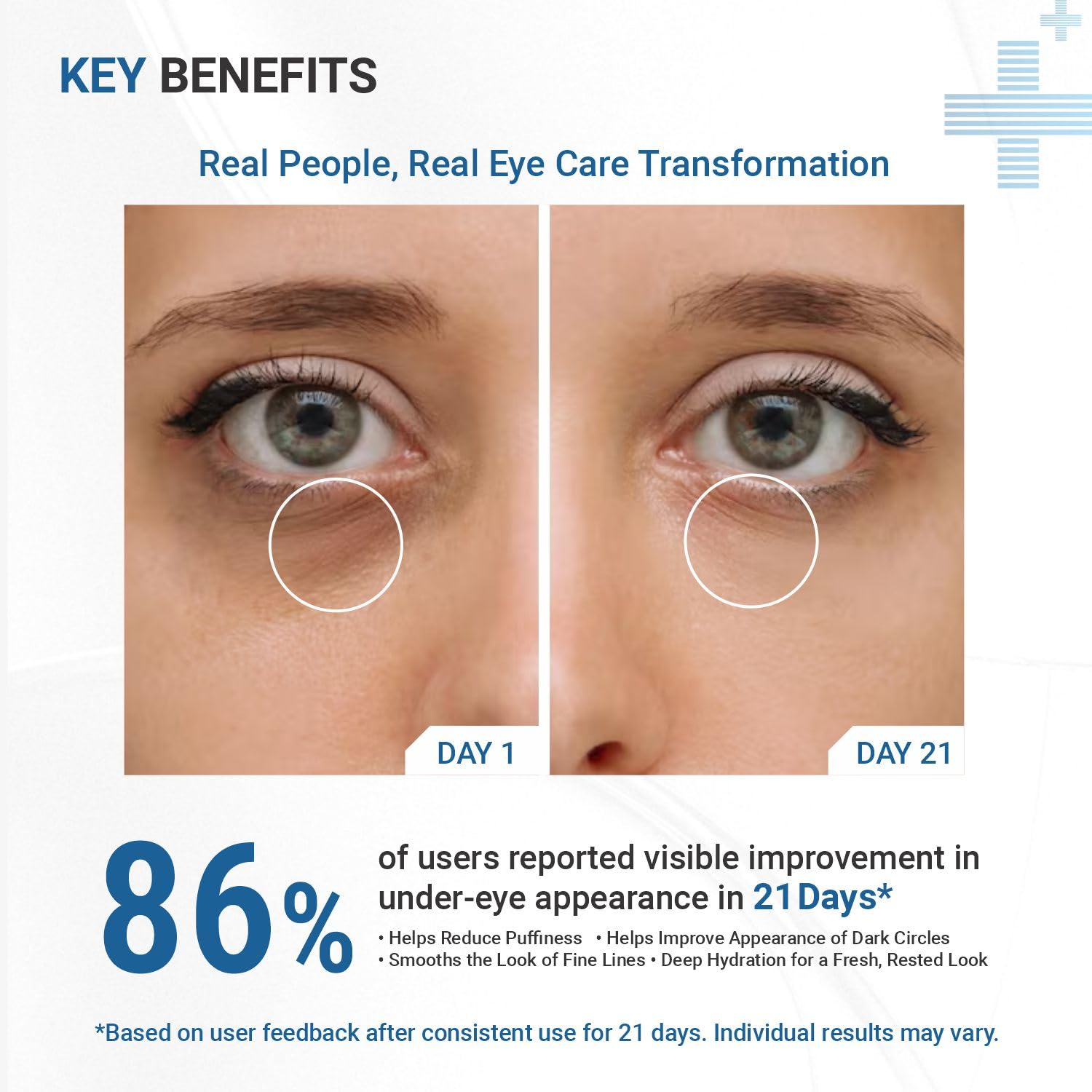 Vitamin K2 1% Under Eye Cream with Caffeine & Retinal | Reduces Dark Circles, Puffiness & Fine Lines | Cooling Metal Roller Applicator | Under Eye Cream For Men & Women | 15 g — Amazon image 5