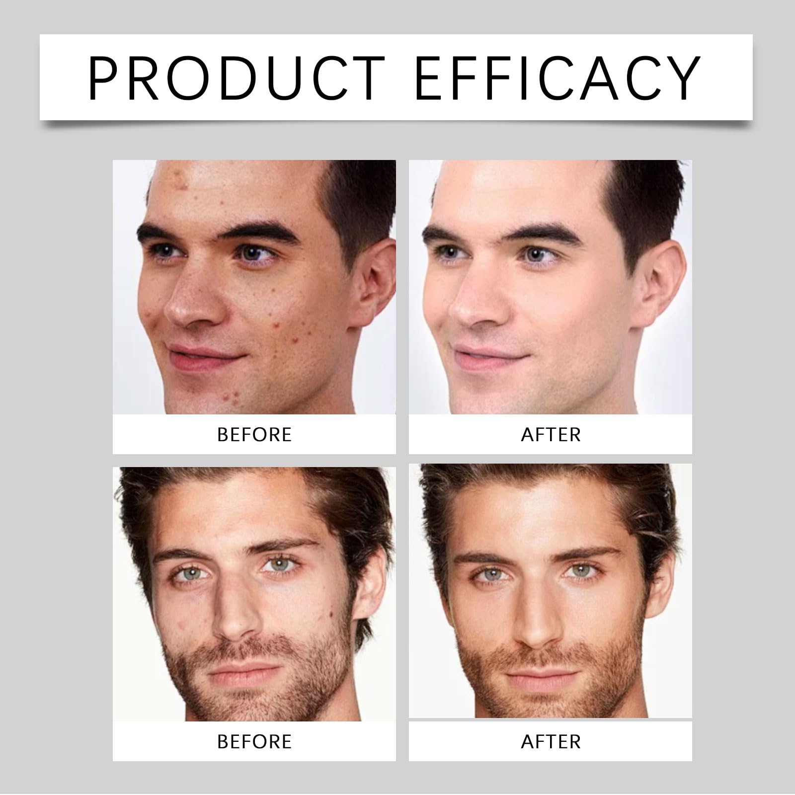 Baume nourrissant au suif pour hommes – Crème visage au suif pour hommes – Crème hydratante pour le visage masculin au lard, Baume nourrissant au gras homme – Crème visage au, soin (8 boîtes)