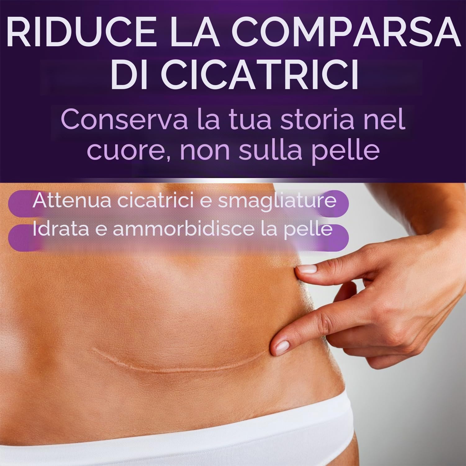 Cicatricure Gel per cicatrici viso e corpo, riduce la comparsa di cicatrici vecchie e nuove, smagliature, chirurgia, lesioni, ustioni e acne, 28,3 g (la confezione può variare)