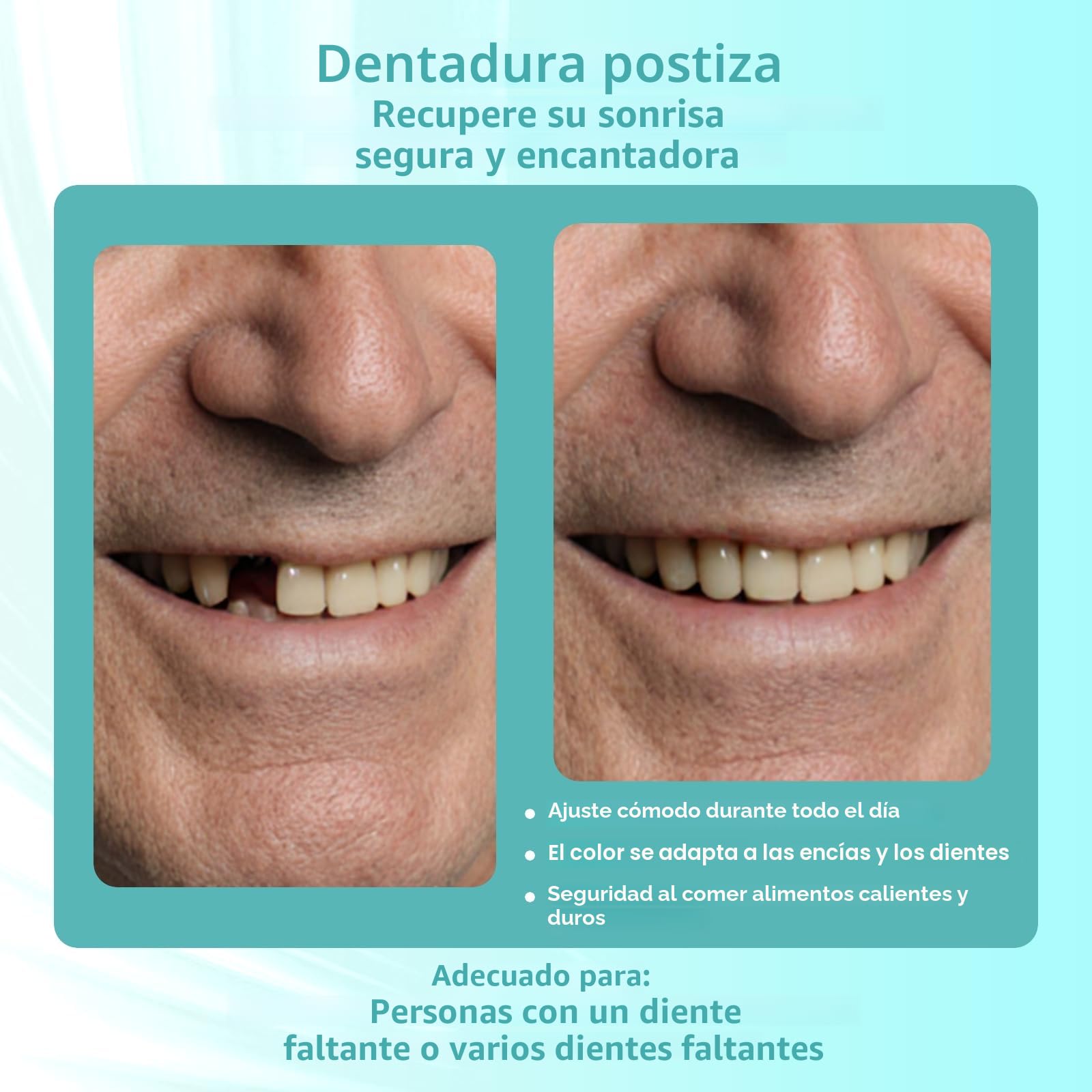Prótesis parcial personalizada para espacios dentales – Prótesis dental provisional extraíble para hombres y mujeres, dentadura con ajuste perfecto. Fácil de usar para una sonrisa perfecta (1 diente)