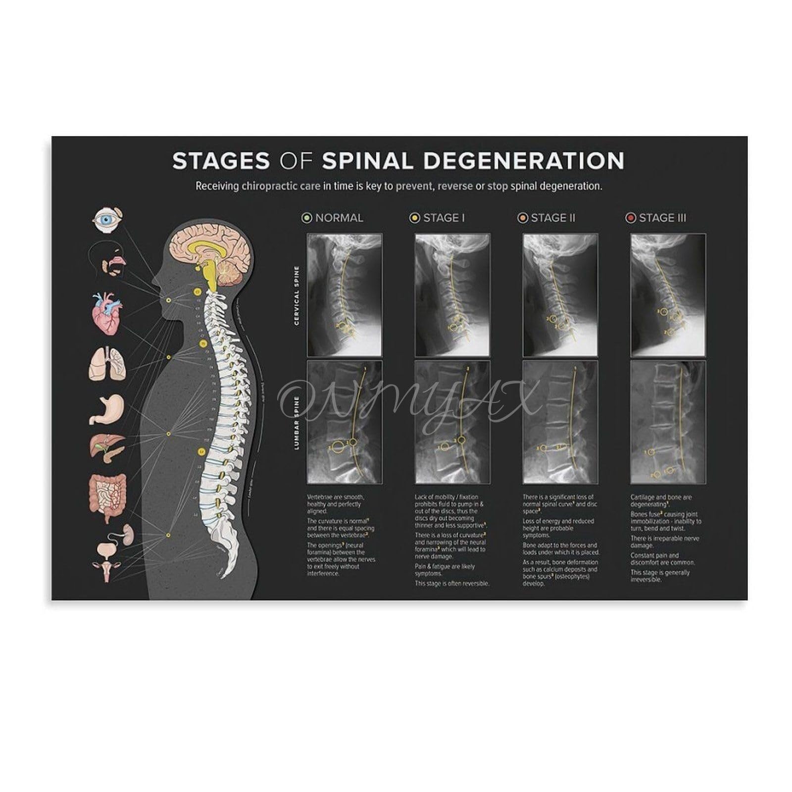REIUAFWYGV Educational Spine Anatomy Poster Chiropractic Chart Vertebrae Canvas Wall-Art for Office
