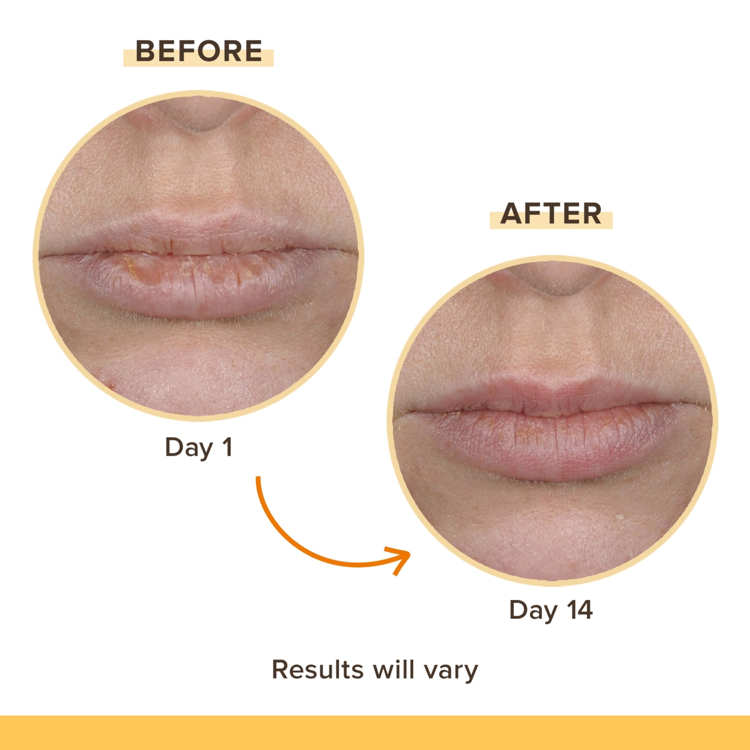 Burt's Bees Rescue Balm Unscented Lip Balm, With Antioxidant-Rich Turmeric, Tint-Free, Natural Origin Lip Care, 2 Tubes, 0.15 oz.