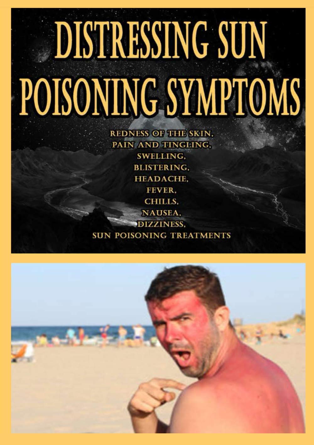 Distressing Sun Poisoning Symptoms: Redness of the Skin, Pain and Tingling, Swelling, Blistering, Headache, Fever, Chills, Nausea, Dizziness, Sun Poisoning Treatments