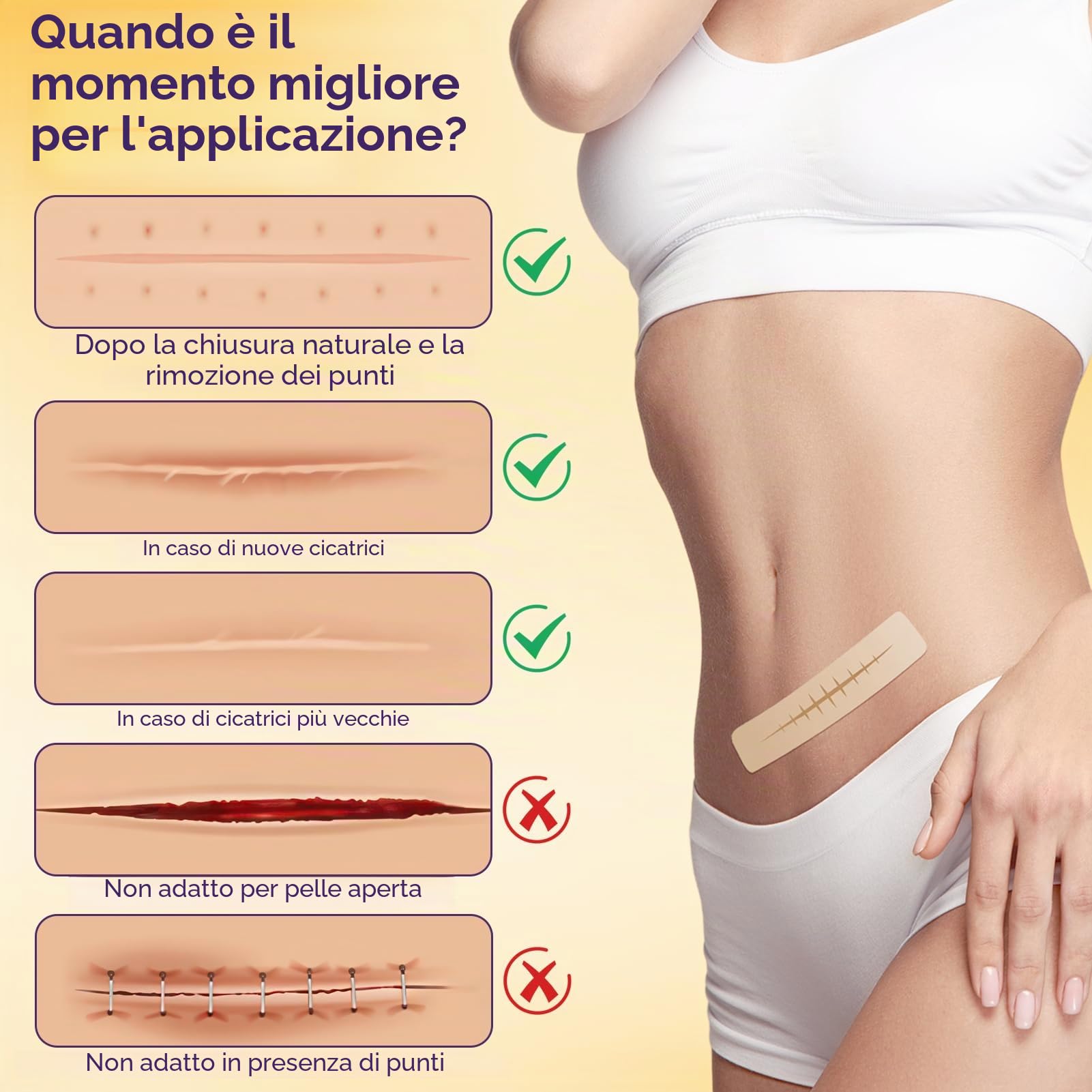 Cerotto per cicatrici in silicone, 4cm x 300 cm, riutilizzabile, color pelle, impermeabile, delicato sulla pelle e traspirante (1 Rotolo)