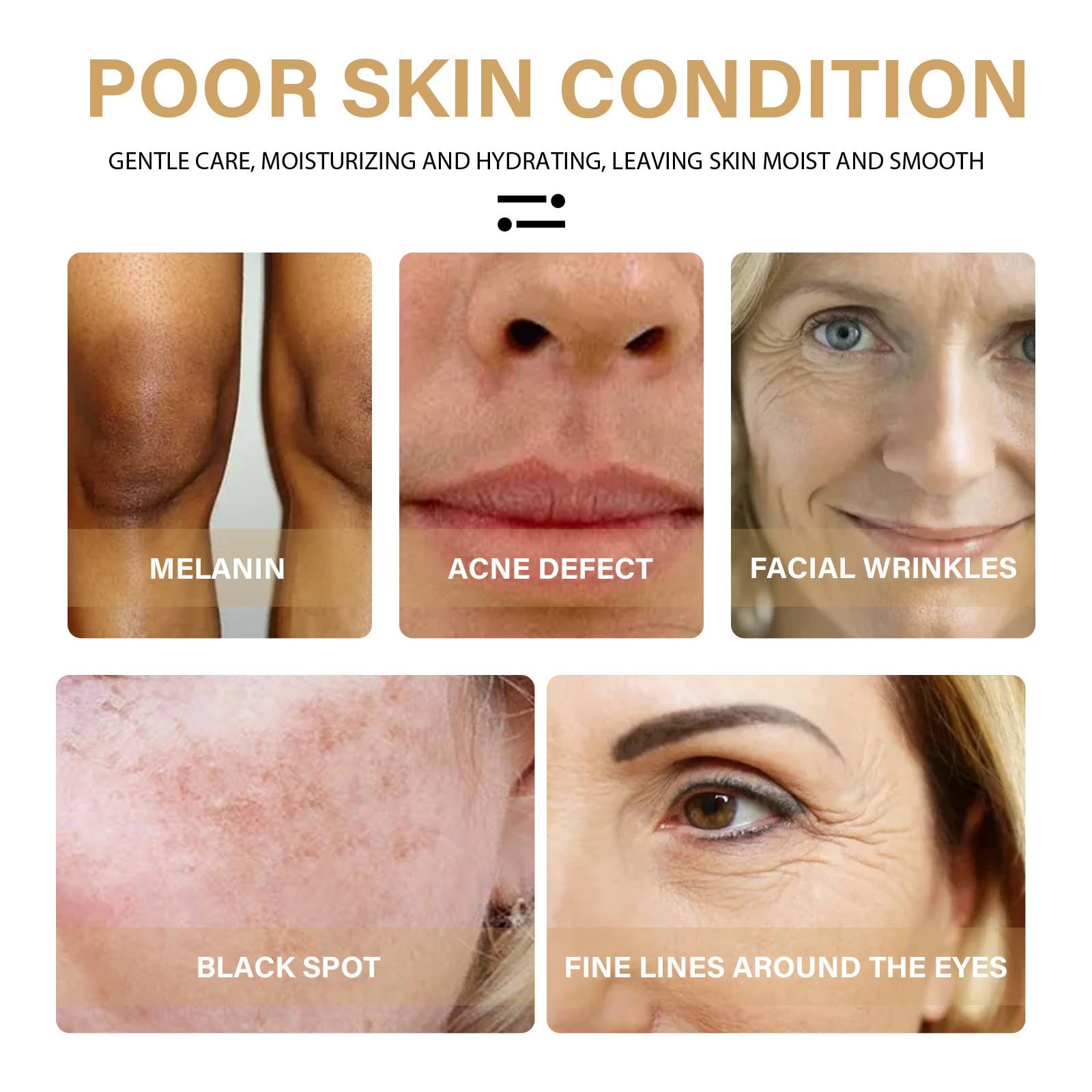 Vitamin C & Turmeric Face Serum For Aging & Wrinkles, Oil With 20% Vitamin C, Improves Dark Spots & Fine Lines - Image 2