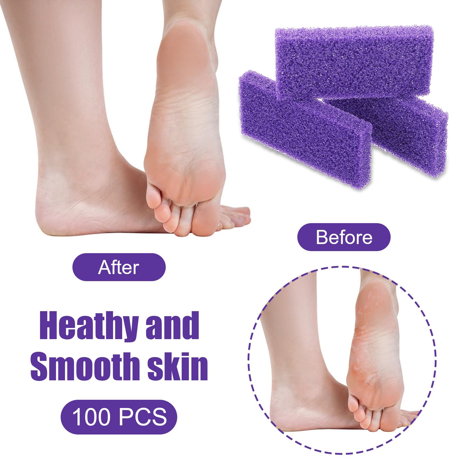 100 piezas de piedra pómez para pies, piedras pómez desechables exfoliantes, herramienta de pedicura para eliminar callos de pies, esponja de limpieza morada, cepillo de doble cara para pies, talón
