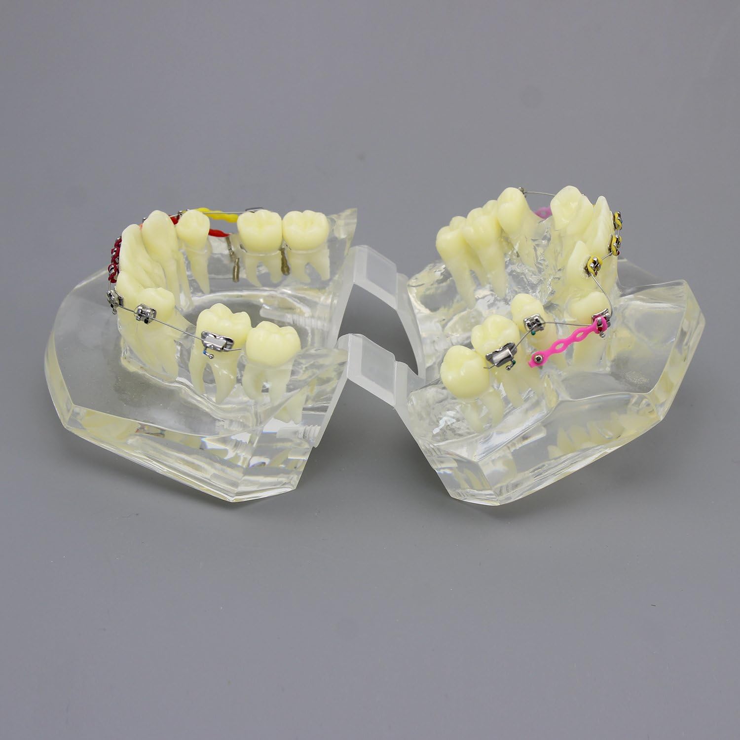 Dental Malocclusion Orthodontic Treatment Teeth Model with Metal Brackets Wires Colorful Ties Chains and Hoops M3005
