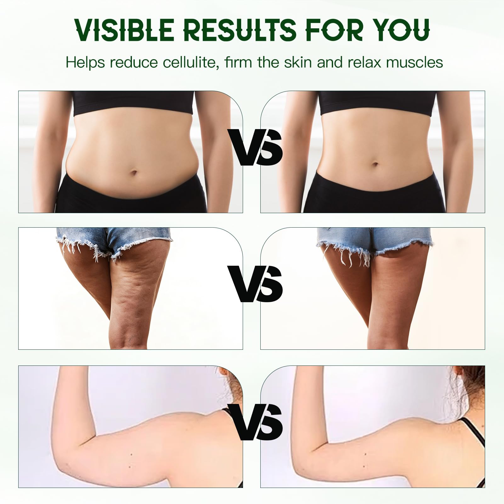 Pjordo Lymphdrainage-Massagegerät, Anti-Cellulite-Massagegerät mit Wärme, Licht & Vibration, reduziert Cellulite & Dehnungsstreifen, Körperformungsmaschine für Bauch, Arm & Bein, Massageöl hilft