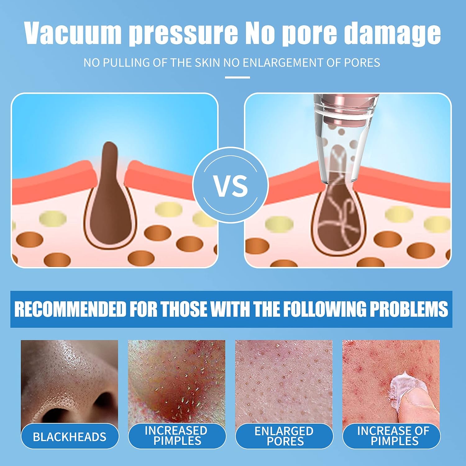 Dolovo Blackhead Remover vacuum USB Rechargeable Acne Comedone Whitehead Extractor with 3 Suction Power 6 Probes Face Cleaning Women & Men skin care tools : Beauty & Personal Care