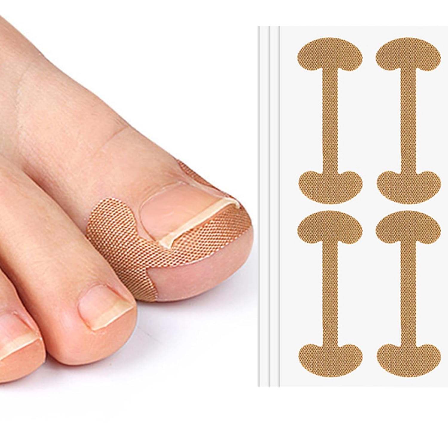 TUPERMAR Ingrown Toenail Kit, Ingrown Toenail Corrector Patch Breathable Self-Adhesive Ingrown Toenail Treatment Elastic Patch Fingernail Care Protects Toe Nail Stickers 5 PCS