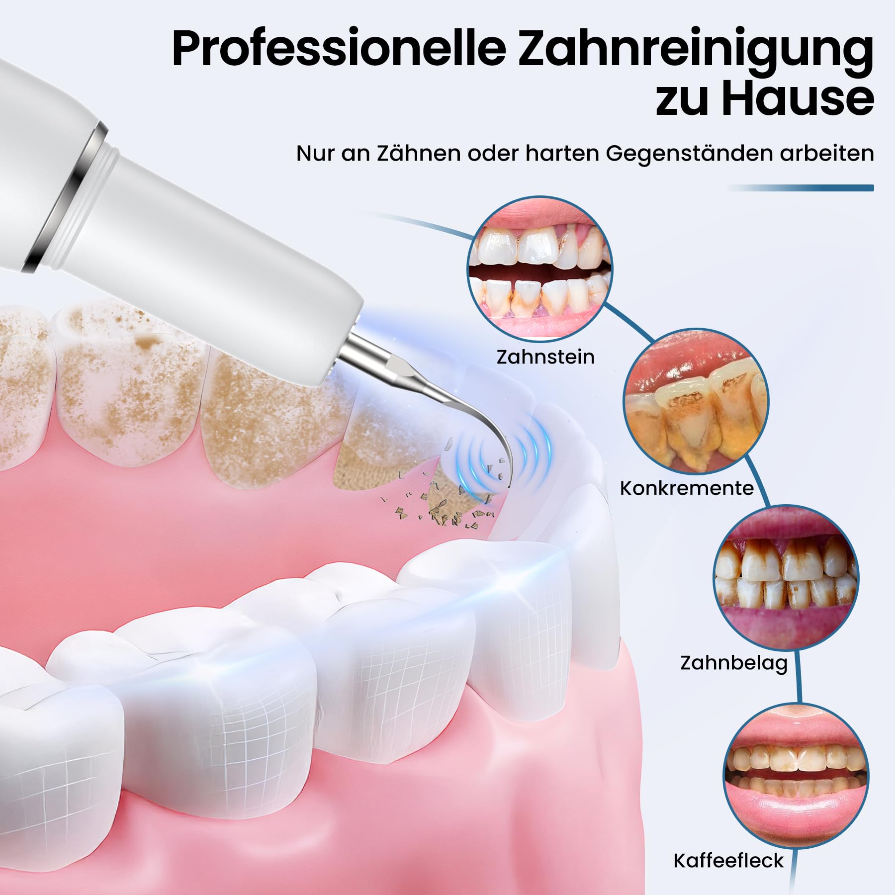 Kit Pulizia Denti Tartaro, Kit Pulizia Denti Animali Domestici, 5 modalità di Spazzolino Denti Cane, Pulizia Denti tartaro con 4 Teste Intercambiabili Per Spazzolare il Tartaro da Persone e Animali